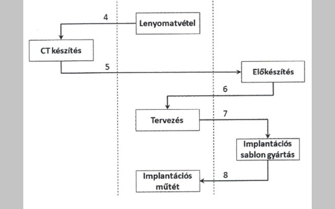 Eljárás és rendszer implantációs sablon tervezésére és előállítására